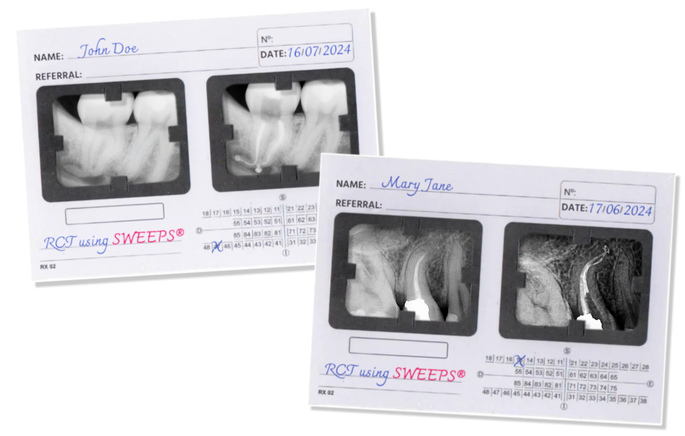 xray card with 2